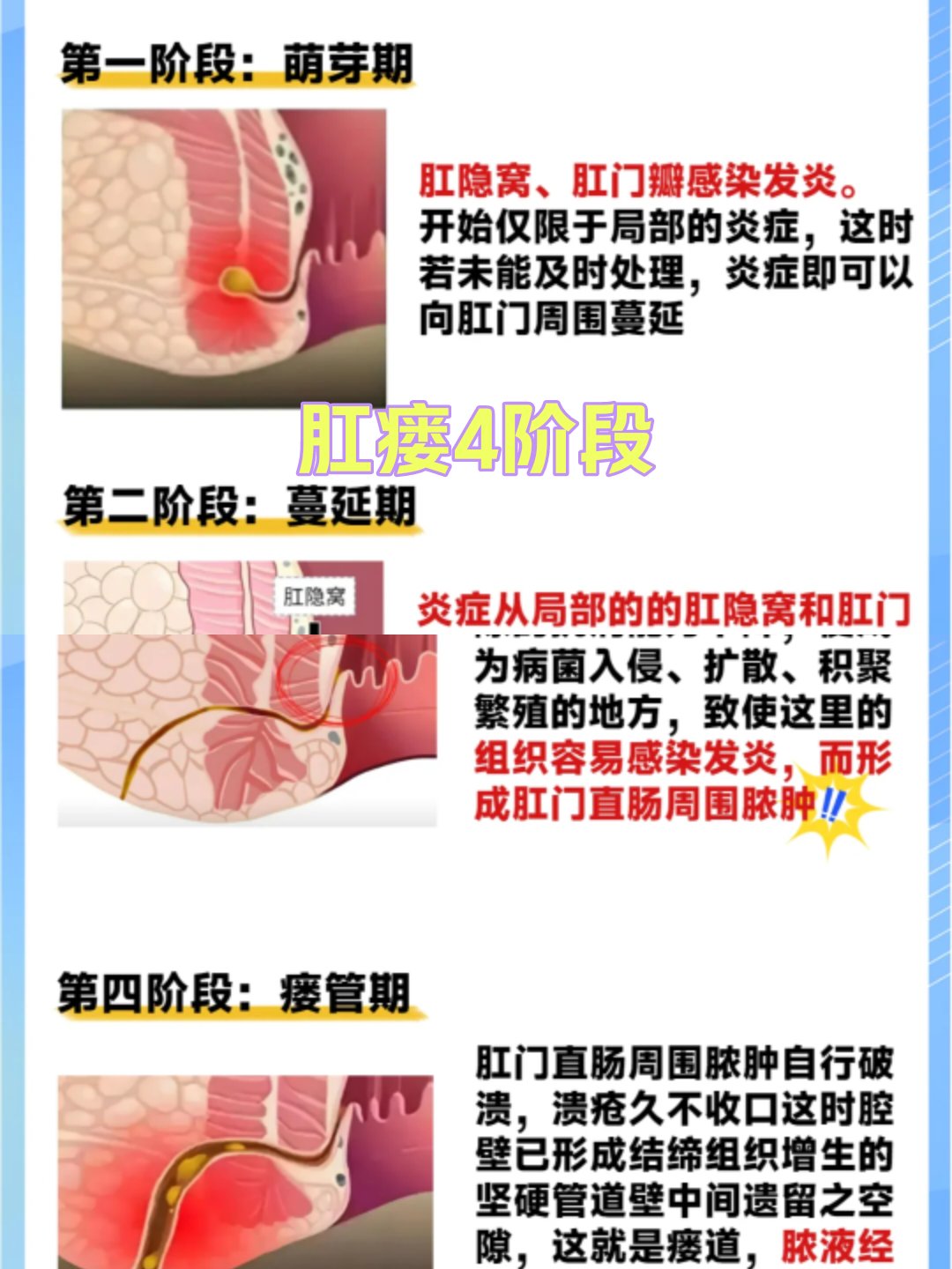 肛门瘘管症状及图片图片