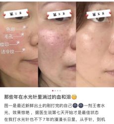-MLP美丽派·问题肌疗愈中心