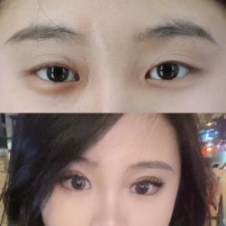 -素美医疗美容·西南眼鼻整形·修复基地