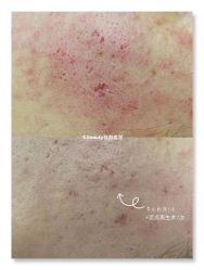 -E.beauty驻颜·痘敏肌调理中心