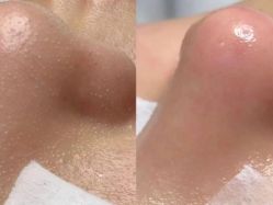 -露德瑪麗科技美肤·美迪迈·华熙生物