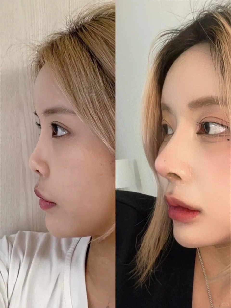 扁塌鼻👃女孩逆袭!
