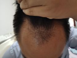 -雍禾植发全国连锁