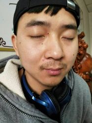 点击看大图 -北京美痣堂古方祛痣斑疣瘊