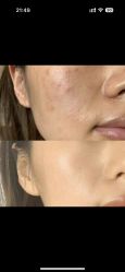 -SKIN79皮肤管理中心