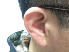 上海隐形助听器专卖店-宁耳听力助听器奥迪康·峰力·西门子(宝山店)