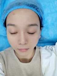 体验后-成都西区医院整形美容