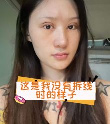 -素美医疗美容·西南眼鼻整形·修复基地