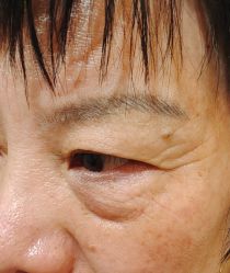 点击看大图 -莲姿娜·半永久纹绣纹眉