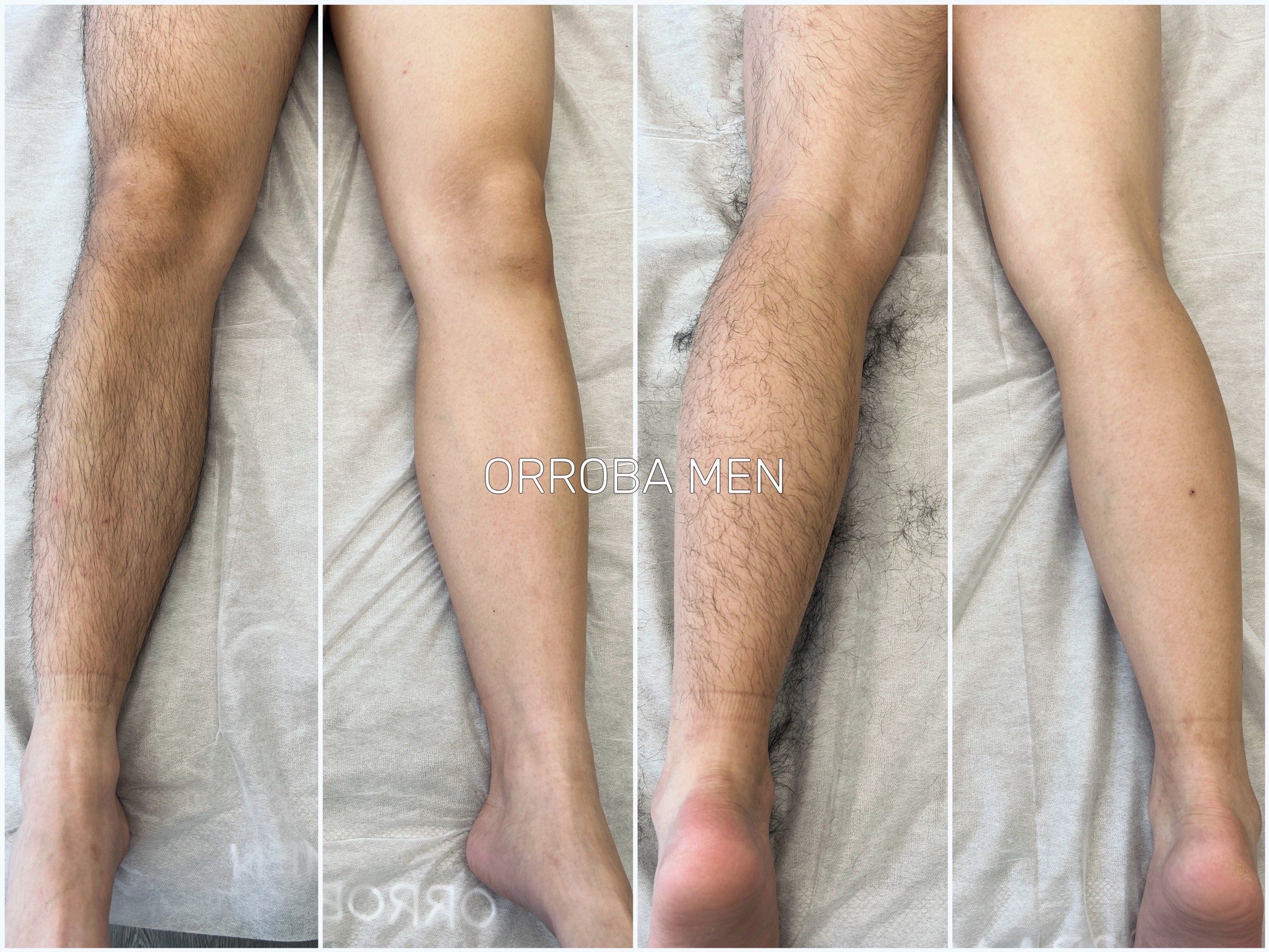 为什么会长腿毛