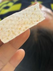 -瑶芳清颜草本祛痘