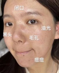 点击看大图 -YESIDO椰岛美容