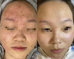 -艾尚妮·美容美体SPA