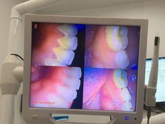 -土豆口腔(凤凰北总店)