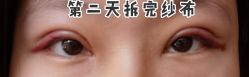-八大处整形