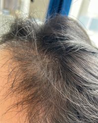 -雍禾植发全国连锁