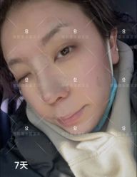 -北京米扬丽格医疗美容·联合丽格鼻整形中心