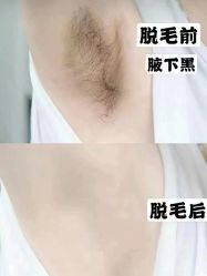 -YESIDO椰岛美容