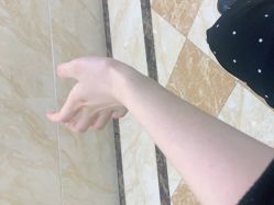体验后-重庆军美医疗美容医院