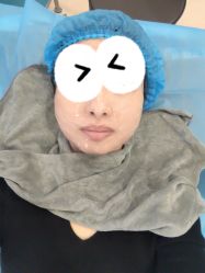 体验后-郑荃丽格医疗美容