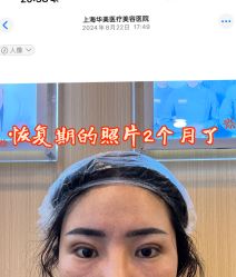 -上海华美医疗美容医院