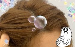 -大麦微针植发全国连锁