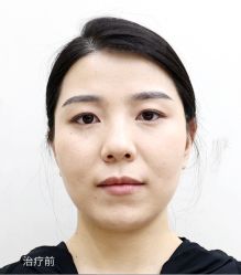 体验前-Dr.U博士医疗美容医院