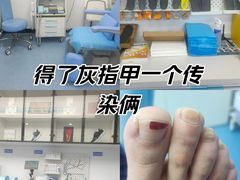 -Andrew指甲专科灰指甲·甲沟炎矫正·3D步态矫形鞋垫定制(上海法华镇路旗舰店)