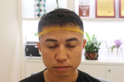 -大麦微针植发丨全国连锁