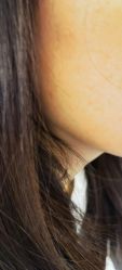 -美瑞莎创美医疗美容