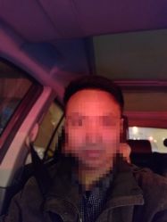 -大麦微针植发全国连锁