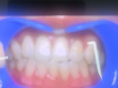 -极光口腔·矫正种植修复(锦江院区)