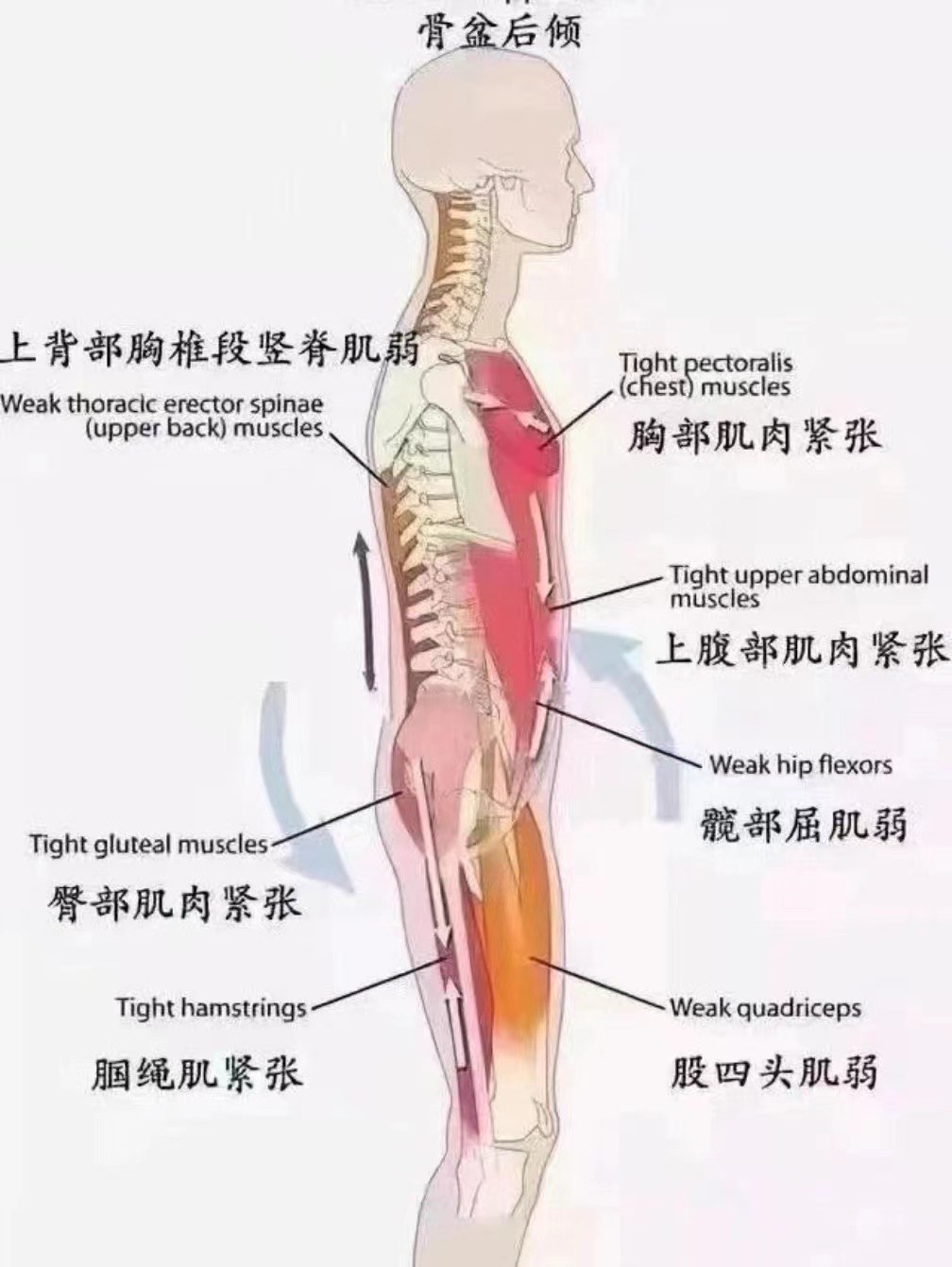 髋关节后伸图片