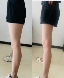 -Lily纤美·科技减脂中心