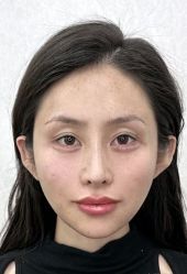 -广州曙光医学美容医院