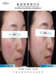 -黎蓓露·徒手骨雕蛋白抗衰·调肤管理