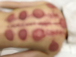 -芳朵美容养生SPA