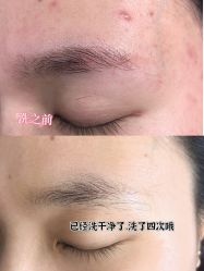 -张小野·专业半永久纹眉