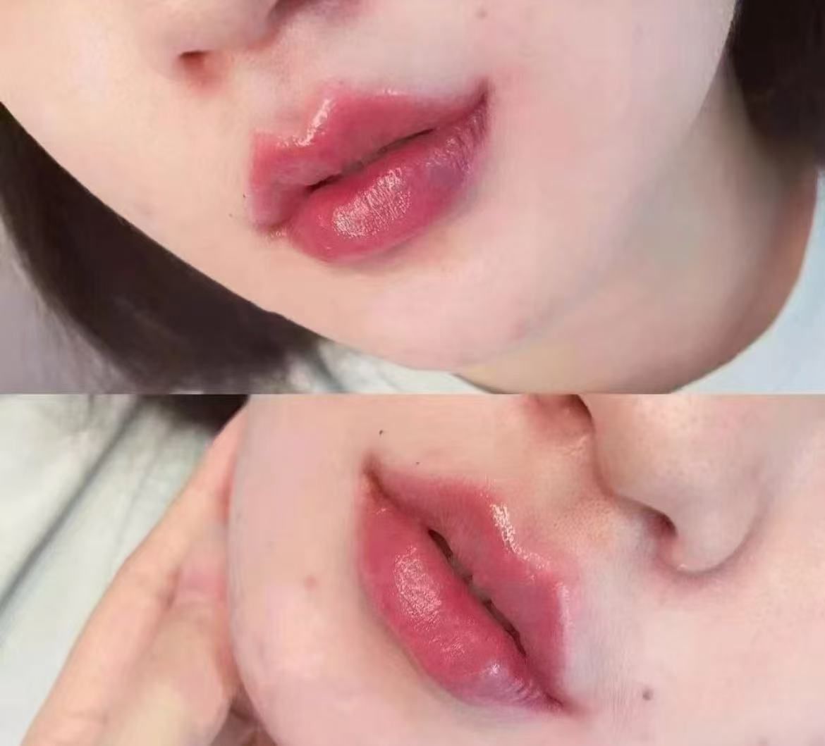 服了,这次周ys💉完💋,自己都想亲
不夸张的嘟嘟唇水润q弹
