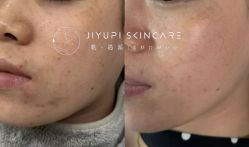 点击看大图 -MLP美丽派·问题肌疗愈中心