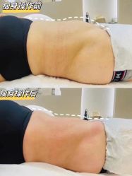 -MLP美丽派·问题肌疗愈中心