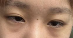 -八大处整形