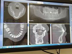 -Dr.Z dental仁康种植矫正中心
