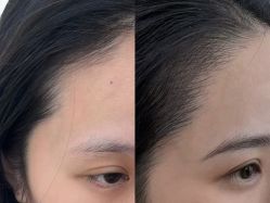 -杨益美学·野生眉半永久纹眉发际线