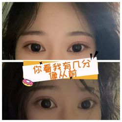-素美医疗美容·西南眼鼻整形·修复基地