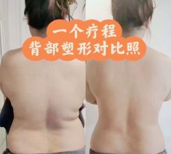 -Lily纤美·科技减脂中心