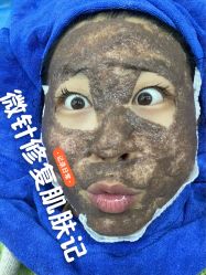 -本草秀复祛痘祛疤·皮肤管理