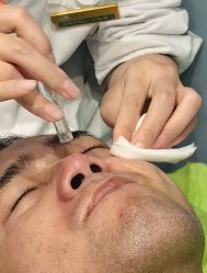-苗医生0感祛痘连锁