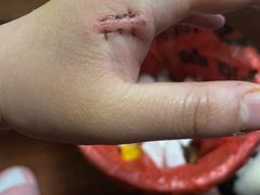 -浙江省立同德医院(翠苑院区)