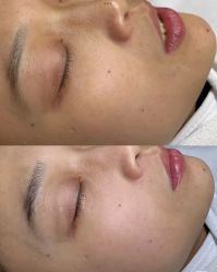 -美愈美肤MEIYU SKIN